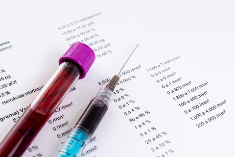 Vitamin-D-Wirkung: Befund eines Blutbildes und darauf eine Ampulle mit Blut und eine Spritze