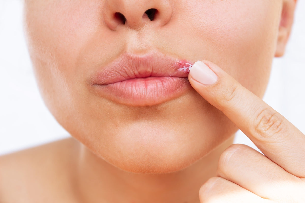 Frau fasst Herpes an der Lippe an