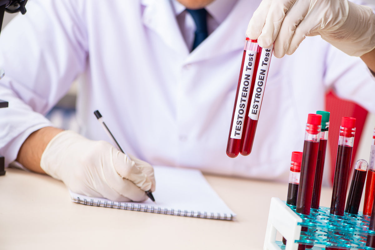 Arzt hält zwei Ampullen mit Blut