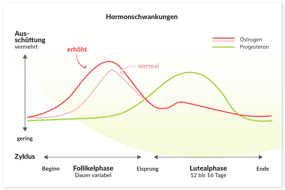 PSM prämenstruelles Syndrom: Infografik Hormonschwankungen während des weiblichen Zyklus