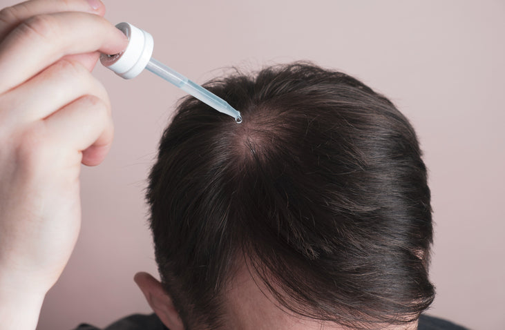 Schwarzkümmelöl Wirkung: Mann tropft sich Schwarzkümmelöl auf die Kopfhaut